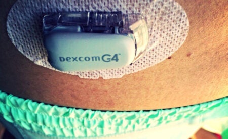 Google on board for next-gen glucose monitoring for diabetics