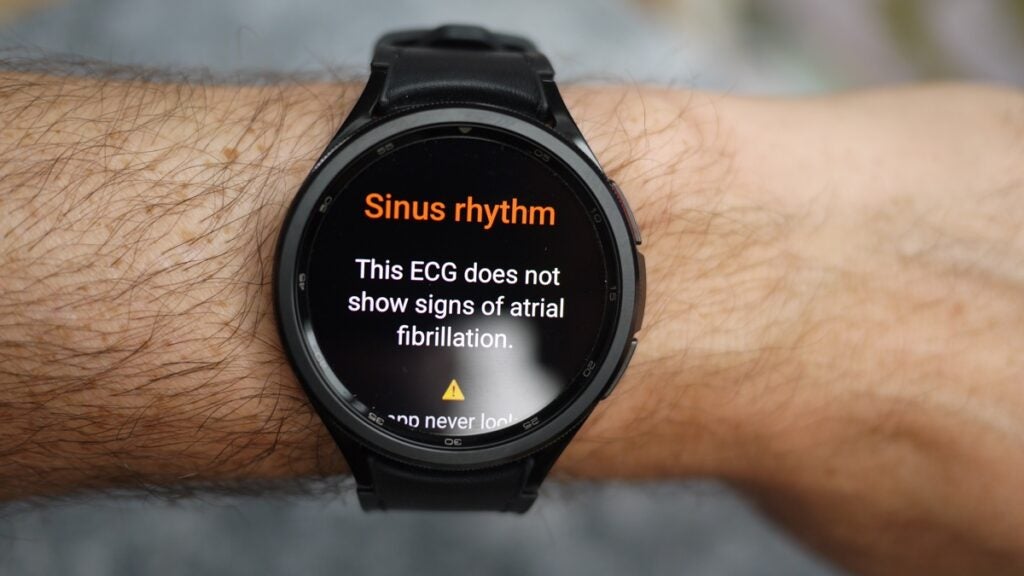 galaxy watch 6 ecg
