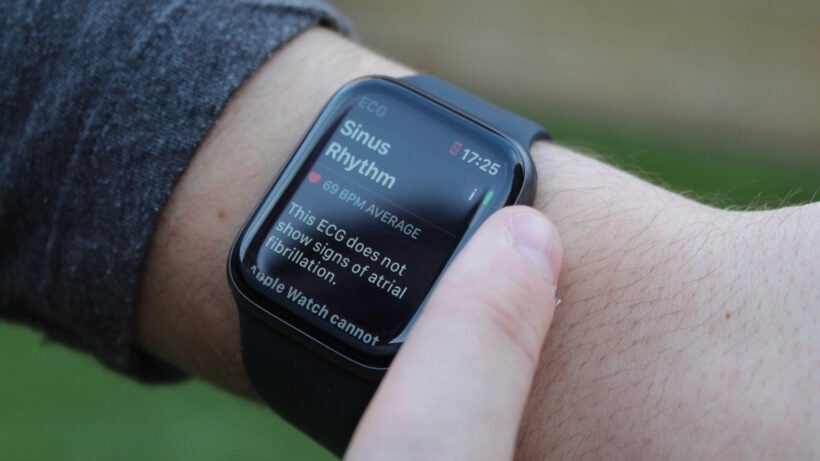 apple watch sinus rhythm