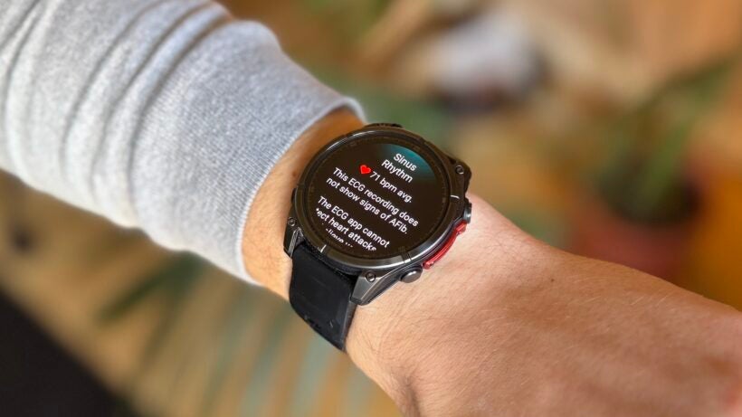garmin-ecg-sinus