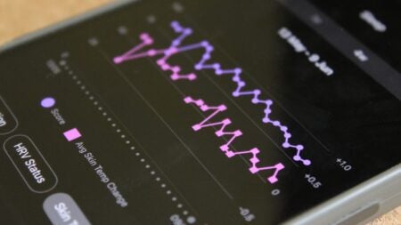 garmin-skin-temp