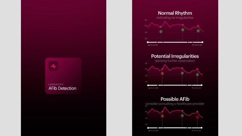 Ultrahuman Afib